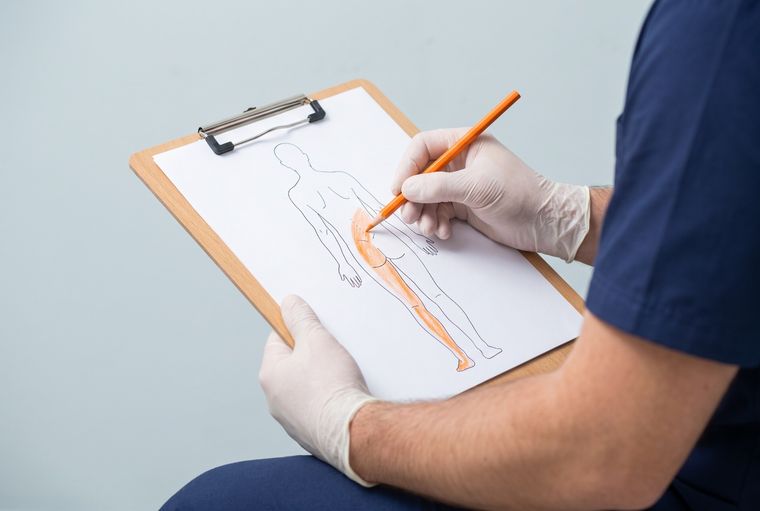 Self-check: shading a body outline from the buttock down the back of the leg to the foot, to map where sciatica pain runs.